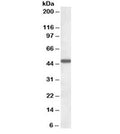 Western blot testing of human liver lysate with AADAT antibody at 1ug/ml. Predicted molecular weight: ~47kDa.