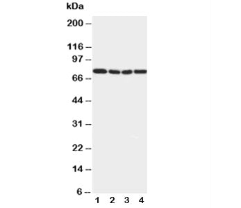 Western blot testing of IRAK1 antibody and Lane 1: rat liver; 2: human placenta; 3: MCF-7; 4: PANC cell lysate. Predicted/observed molecular weight: ~76 kDa.