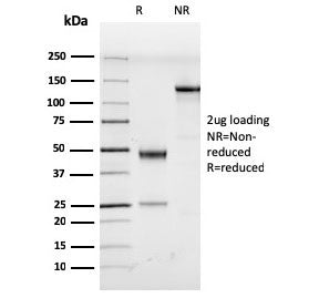 SDS-PAGE analysis of purified, BSA-free HHV8 antibody (clone LN53) as confirmation of integrity and purity.