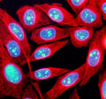 Immunofluorescent staining of TCOF1 using anti-TCOF1 antibody (green) and anti-Beta Tubulin antibody (red). TCOF1 was detected in an immunocytochemical section of human SIHA cells. Enzyme antigen retrieval was performed using IHC enzyme antigen retrieval reagent for 15 mins. The cells were blocked with 10% goat serum. And then incubated with 5 ug/ml rabbit anti-TCOF1 antibody and mouse anti-Beta Tubulin antibody overnight at 4oC.