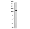 Western blot testing of ABCB4 antibody and human HepG2 cell lysate. Predicted molecular weight ~142 kDa.