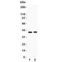 Western blot testing of IRF4 antibody and Lane 1: HeLa; 2: Jurkat lysate; Predicted molecular weight ~51 kDa, observed here at ~40 kDa.