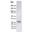 Western blot testing of human liver tissue lysate using recombinant HSP27 antibody (clone HSPB1/6490R). Predicted molecular weight: 23-27 kDa.