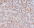 Western blot testing of human plasma lysate with Serum Amyloid A antibody. Predicted molecular weight ~13 kDa.