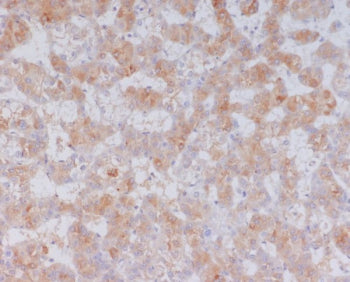 Western blot testing of human plasma lysate with Serum Amyloid A antibody. Predicted molecular weight ~13 kDa.