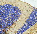 Immunohistochemical analysis of C9orf72 protein using C9orf72 antibody and paraffin-embedded zebrafish brain tissue. HIER: boil tissue sections in pH8 EDTA for 20 min and allow to cool before testing.