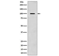 Western blot testing of mouse brain lysate with APP antibody. Predicted molecular weight 79~120 kDa depending on glycosylation level.