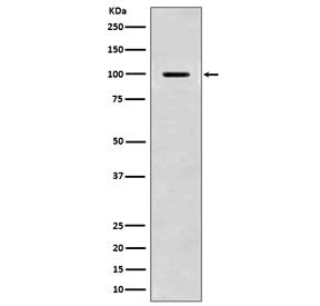 Western blot testing of mouse brain lysate with APP antibody. Predicted molecular weight 79~120 kDa depending on glycosylation level.