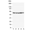 Western blot testing of HDAC2 antibody and Lane 1: MM453; 2: MCF-7; 3: HeLa; 4: SMMC-7721; 5: COLO320. Predicted molecular weight: 55-60 kDa.
