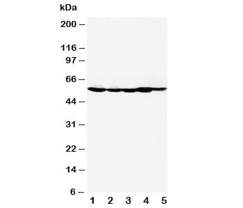 Western blot testing of HDAC2 antibody and Lane 1: MM453; 2: MCF-7; 3: HeLa; 4: SMMC-7721; 5: COLO320. Predicted molecular weight: 55-60 kDa.