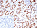 IHC staining of FFPE human kidney tissue with Fibroblast Growth Factor 23 antibody (clone FGF23/9059). Inset: PBS used in place of primary Ab (secondary Ab negative control). HIER: boil tissue sections in pH 9 10mM Tris with 1mM EDTA for 20 min and allow to cool before testing.