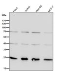 All lanes use the GRB2 antibody at 1:1K dilution for 1 hour at room temperature.
