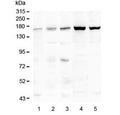 Western blot testing of 1) placenta, 2) Caco-2, 3) human HeLa, 4) rat liver and 5) mouse liver lysate with TEK antibody at 0.5ug/ml. Predicted molecular weight: ~126 kDa but may be observable at 130-165 kDa.