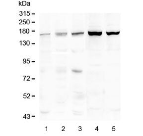 Western blot testing of 1) placenta, 2) Caco-2, 3) human HeLa, 4) rat liver and 5) mouse liver lysate with TEK antibody at 0.5ug/ml. Predicted molecular weight: ~126 kDa but may be observable at 130-165 kDa.