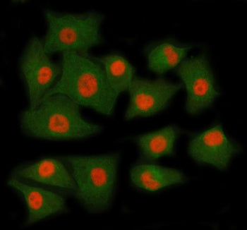 Immunofluorescent staining of RING1 using anti-RING1 antibody (red) and anti-Beta Tubulin antibody (green). RING1 was detected in immunocytochemical section of cell. Enzyme antigen retrieval was performed using IHC enzyme antigen retrieval reagent for 15 mins. The cells were blocked with 10% goat serum. And then incubated with 5 ug/ml rabbit anti-RING1 antibody and mouse anti-Beta Tubulin antibody overnight at 4oC.
