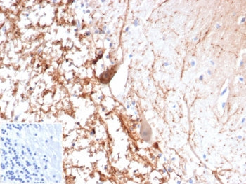 IHC staining of FFPE human brain tissue with recombinant Calretinin antibody (clone CALB2/4688R). Inset: PBS used in place of primary Ab (secondary Ab negative control). HIER: boil tissue sections in pH 9 10mM Tris with 1mM EDTA for 20 min and allow to cool before testing.