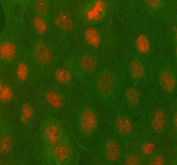 Immunofluorescent staining of PBX4 using anti-PBX4 antibody (red) and anti-Beta Tubulin antibody (green). PBX4 was detected in immunocytochemical section of cell. Enzyme antigen retrieval was performed using IHC enzyme antigen retrieval reagent for 15 mins. The cells were blocked with 10% goat serum. And then incubated with 5 ug/ml rabbit anti-PBX4 antibody and mouse anti-Beta Tubulin antibody overnight at 4oC.