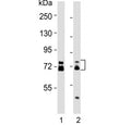 Western blot testing of human 1) HCT-116 and 2) MCF7 cell lysates with ESRP1 antibody. Predicted molecular weight: 68-76 kDa (multiple isoforms).