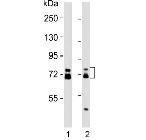 Western blot testing of human 1) HCT-116 and 2) MCF7 cell lysates with ESRP1 antibody. Predicted molecular weight: 68-76 kDa (multiple isoforms).