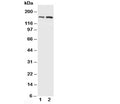 Western blot testing of NMDAR2B antibody and Lane 1: rat brain; 2: mouse brain. Predicted molecular weight ~166kDa.