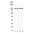 Western blot testing of NALP3 antibody and lysates from the human tumor cell lines 1: HeLa; 2: MCF-7; 3: Jurkat; 4: HEPG2. Predicted molecular weight ~118 kDa.