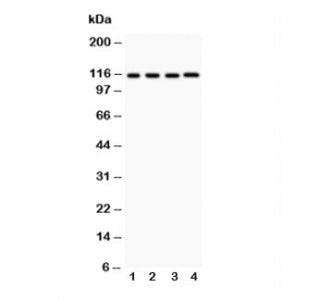 Western blot testing of NALP3 antibody and lysates from the human tumor cell lines 1: HeLa; 2: MCF-7; 3: Jurkat; 4: HEPG2. Predicted molecular weight ~118 kDa.