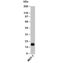 Western blot testing of human samples with Survivin antibody at 2ug/ml. Predicted molecular weight ~16 kDa.