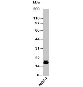 Western blot testing of human samples with Survivin antibody at 2ug/ml. Predicted molecular weight ~16 kDa.