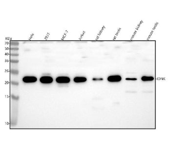 Western blot analysis of IDNK using anti-IDNK antibody. Lane 1: human Hela whole cell lysates, Lane 2: human 293T whole cell lysates, Lane 3: human MCF-7 whole cell lysates, Lane 4: human Jurkat whole cell lysates, Lane 5: rat kisney tissue lysates, Lane 6: rat testis tissue lysates, Lane 7: mouse kidney tissue lysates, Lane 8: mouse testis tissue lysates. After electrophoresis, proteins were transferred to a nitrocellulose membrane at 150 mA for 50-90 min.