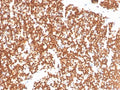 IHC staining of FFPE human thymus with NR5A1 antibody. HIER: boil tissue sections in pH 9 10mM Tris with 1mM EDTA for 20 min and allow to cool before testing.