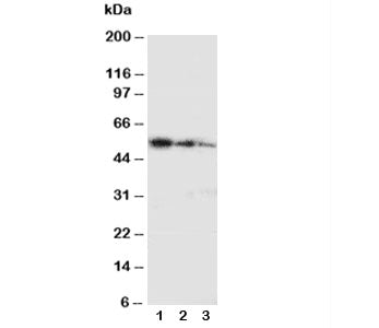 Western blot testing with Ki-67 antibody and partial human recombinant protein; Lane 1: 10ng; 2: 5ng; 3: 2.5ng