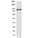 Western blot testing of TRPC6 antibody and Lane 1: rat lung; 2: human 293T cell lysate. Predicted molecular weight: ~106 kDa.