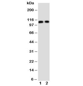Western blot testing of TRPC6 antibody and Lane 1: rat lung; 2: human 293T cell lysate. Predicted molecular weight: ~106 kDa.