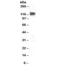 Western blot testing of NIH3T3 lysate with CBL antibody at 2ug/ml. Expected molecular weight: 100-120 kDa.