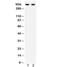 Western blot testing of 1) human HeLa and 2) SW620 lysate with ITPR3 antibody. Predicted molecular weight ~300 kDa.