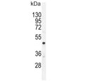 Western blot testing of human A549 cell lysate with CMGA antibody. Expected molecular weight: 50-75 kDa depending on glycosylation level.