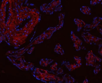 Immunofluorescent staining of FFPE human placental tissue with Collagen I antibody (red) and DAPI nuclear stain (blue). HIER: steam section in pH8 EDTA buffer for 20 min.