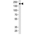 Western blot analysis of lysate from rat brain tissue using Insrr antibody at 1:1000. Expected size: ~80 kDa, 144 kDa.