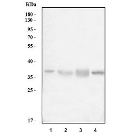 Western blot testing of 1) human HepG2, 2) human HCCT, 3) human HCCP and 4) mouse liver tissue lysate with CTSL antibody. Expected molecular weight: 38-41 kDa with multiple smaller processed/active forms.