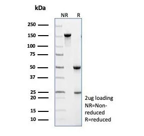 SDS-PAGE analysis of purified TRAF1 antibody (clone TRAF1/3299) as confirmation of integrity and purity.