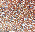 Immunohistochemical staining of SNX16 using anti-SNX16 antibody. SNX16 was detected in a paraffin-embedded section of human liver tissue. Heat mediated antigen retrieval was performed in EDTA buffer (pH 8.0, epitope retrieval solution). The tissue section was blocked with 10% goat serum. The tissue section was then incubated with 2 ug/ml rabbit anti-SNX16 antibody overnight at 4oC. Peroxidase Conjugated Goat Anti-rabbit IgG was used as secondary antibody and incubated for 30 min at 37oC.