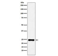 Western blot testing of human HeLa cell lysate with BAG2 antibody. Predicted molecular weight ~22 kDa.