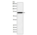 Western blot testing of human HeLa cell lysate with IGF2BP3 antibody. Predicted molecular weight ~64 kDa.