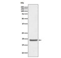 Western blot testing of human Jurkat cell lysate with SOD1 antibody. Predicted molecular weight ~16 kDa.