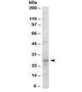 Western blot testing of human duodenum lysate with 15-PGDH antibody at 0.1ug/ml. Predicted molecular weight: ~29 kDa.