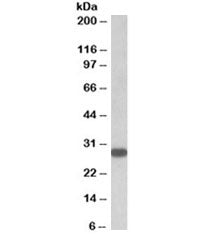 Western blot testing of human thyroid gland lysate with TSHR antibody at 0.5ug/ml. Predicted molecular weight: ~87 kDa (long) and ~28 kDa (short) forms.