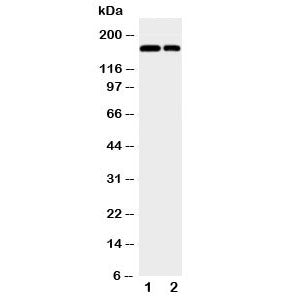 Western blot testing of CD11b antibody and Lane 1: Jurkat; 2: Raji; Observed molecular weight: 127~170 kDa due to glycosylation.
