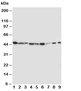 Western blot testing of IDO antibody and Lane 1: SMMC-7721; 2: A549; 3: human placenta; 4: SW620; 5: U87; 6: 293T; 7: A431; 8: HeLa; 9: COLO320 cell lysate. Predicted/observed molecular weight ~45kDa.