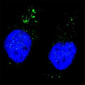 Fluorescent image of Chloroquine treated U251 cells stained with phospho-ULK1 antibody at 1:200. Immunoreactivity is localized to autophagic vacuoles in the cytoplasm.