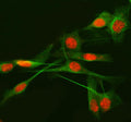Immunofluorescent staining of METTL17 using anti-METTL17 antibody (red) and anti-Beta Tubulin antibody (green). METTL17 was detected in immunocytochemical section of HELA cell. Enzyme antigen retrieval was performed using IHC enzyme antigen retrieval reagent for 15 mins. The cells were blocked with 10% goat serum. And then incubated with 5 ug/ml rabbit anti-METTL17 antibody and mouse anti-Beta Tubulin antibody overnight at 4oC.